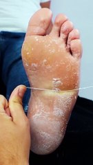 A little foot pampering...