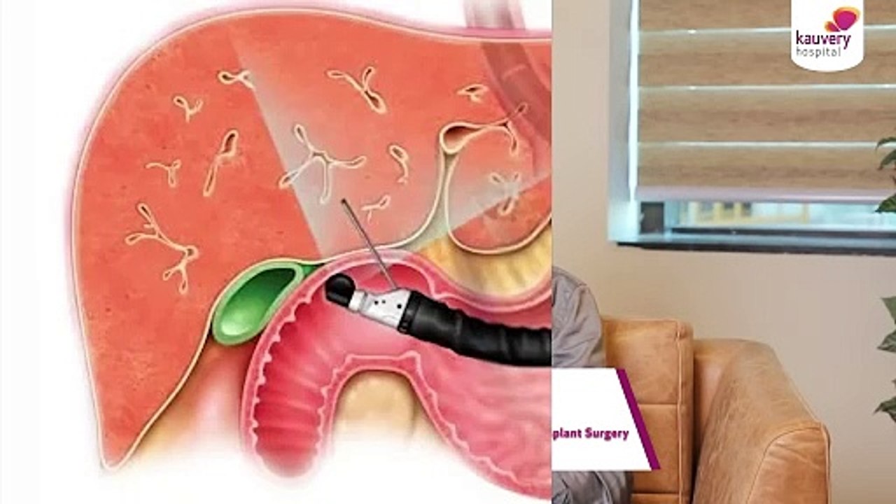 Is Your Liver Healthy? Essential Tests for Diagnosing Cirrhosis