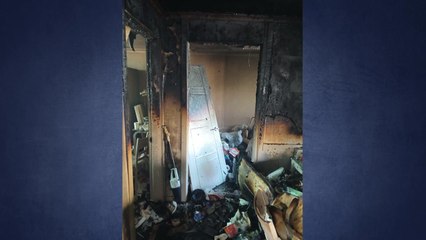 인천 심곡동 빌라 불...초등생 얼굴 2도 화상 / YTN