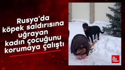 Rusya'da köpek saldırısına uğrayan kadın çocuğunu korumaya çalıştı