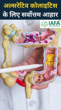 Best Diet Plan for Ulcerative Colitis | Diet Chart For Ulcerative Colitis