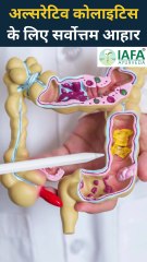 Best Diet Plan for Ulcerative Colitis | Diet Chart For Ulcerative Colitis