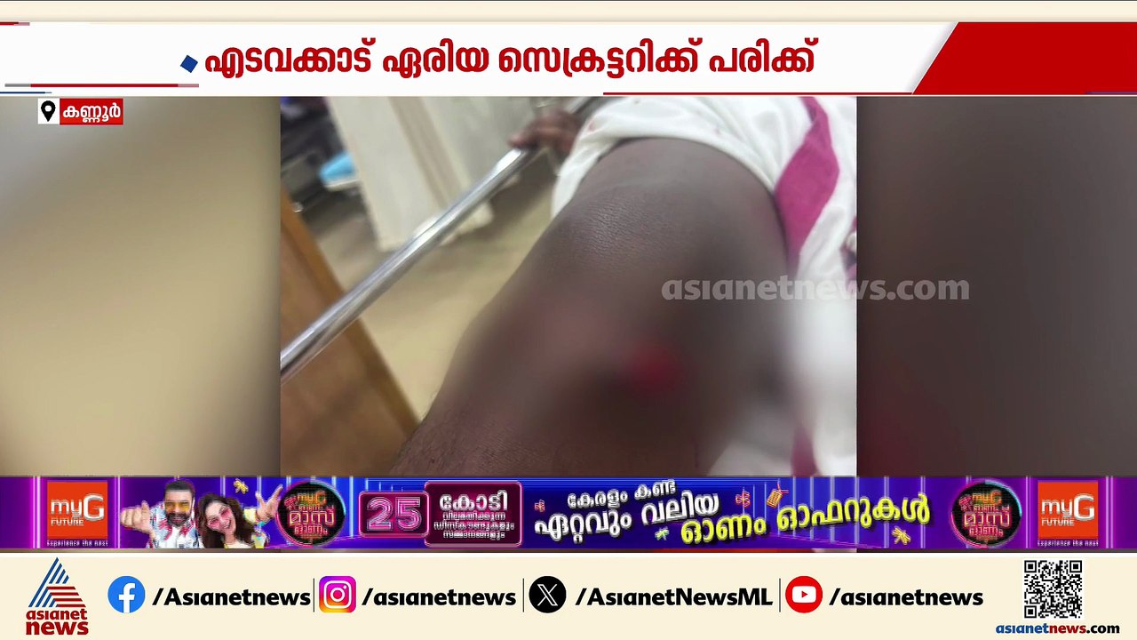 കണ്ണൂരിൽ SFI പ്രവർത്തകന് കുത്തേറ്റു; ആക്രമം നടത്തിയത് ബൈക്കിലെത്തിയ സംഘം