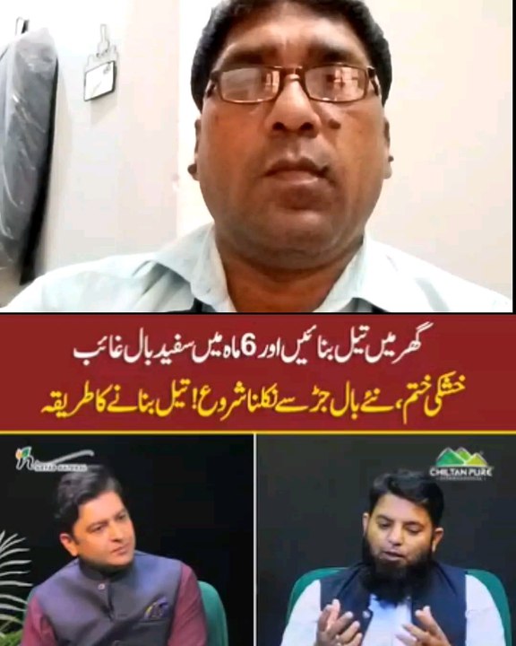 Oil For Whiye Hairs & Dandrauf