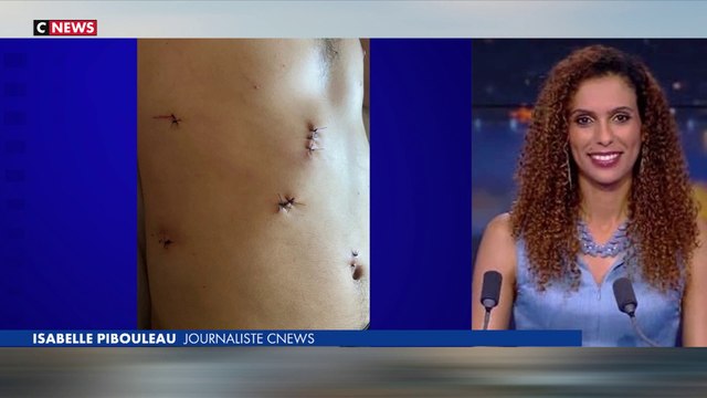 Une journaliste de CNews agressée dans le tramway