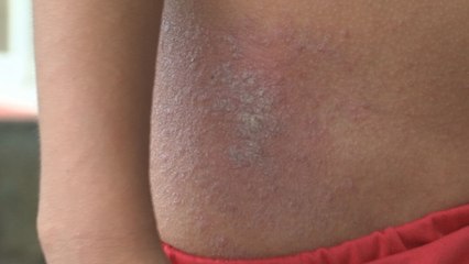 Vecinos de Caimitillo denuncian bruma sospechosa y posibles efectos en la salud