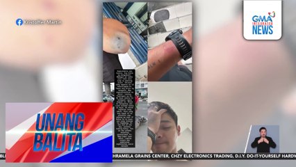 Kristoffer Martin, sugatan matapos mabangga ng motorsiklo habang nagbibisikleta siya sa Marcos Highway | Unang Balita