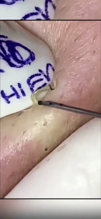 Traitement Visage DIY : Peau de Rêve à Petit Prix !