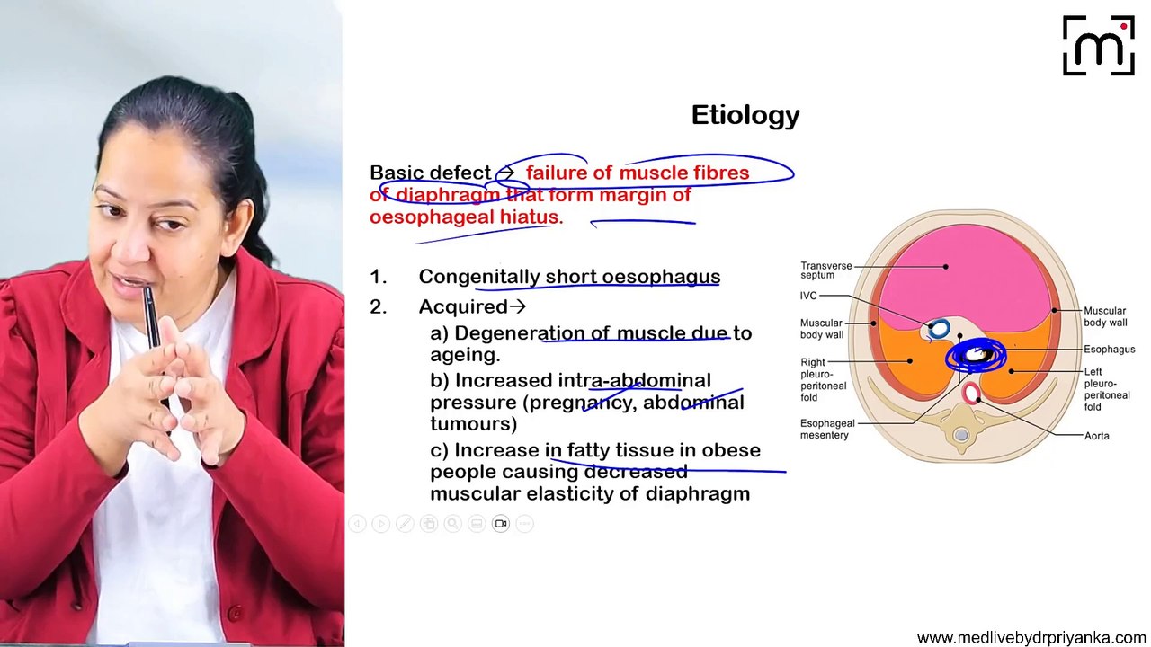 4. Hiatus Hernia