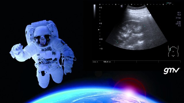 Del espacio a los hospitales: el proyecto que busca acelerar los diagnósticos en atención primaria