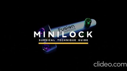 Best MiniLock Service Provider in the USA – Expert Bunion Correction Specialists