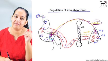 8. Hemochromatosis