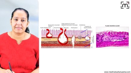 11. Pyogenic Liver Abscess,Amoebic Liver, Hydatid Disease