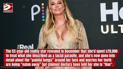 Brandi Glanville has appealed for help amid her ongoing health issues