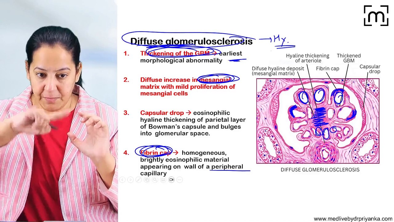 5. Diabetic Nephropathy