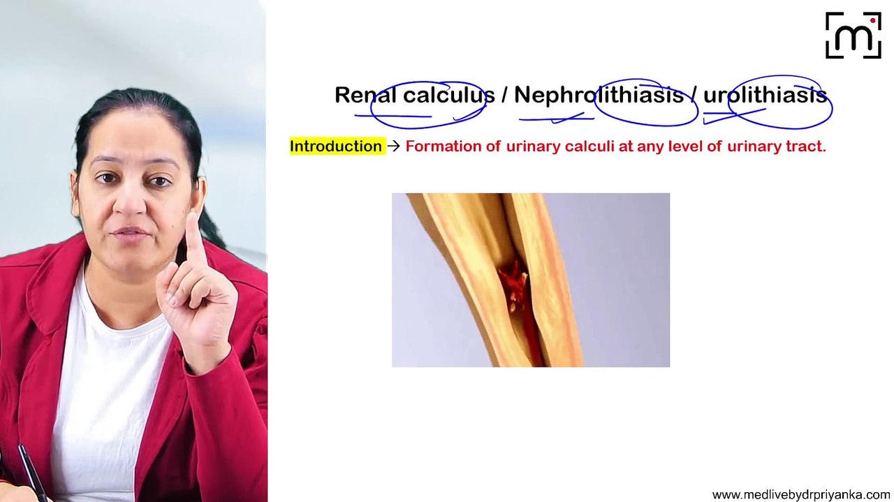 7. Renal Calculus & Hydronephrosis