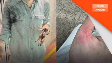 Tangan wanita melecur 'power bank' meletup dalam MRT