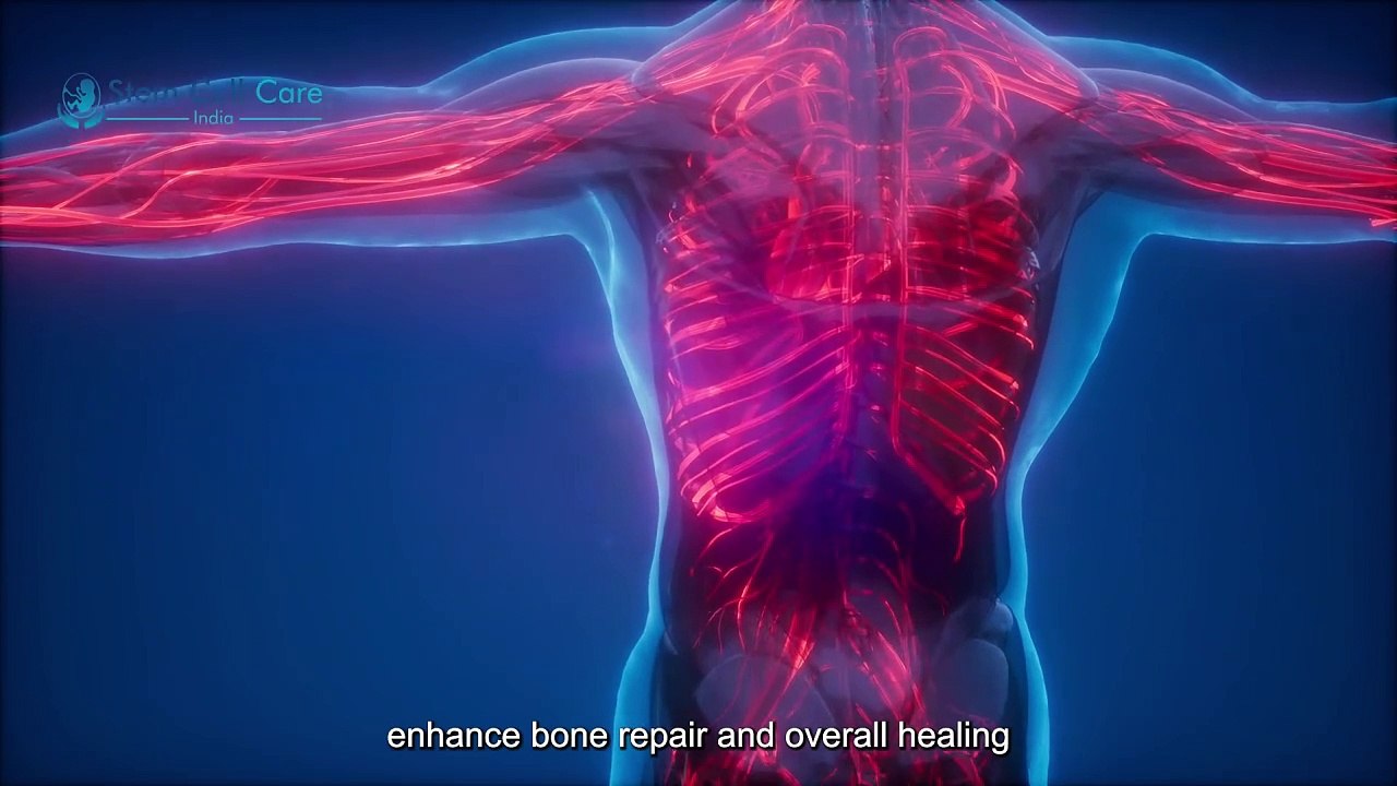 The Future of Avascular Necrosis Treatment: Exosome and Stem Cell Therapy |