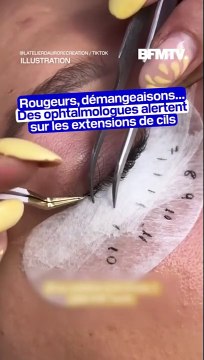 Allergies, démangeaisons: des ophtalmologues alertent sur la pose d’extensions de cils mal réalisées