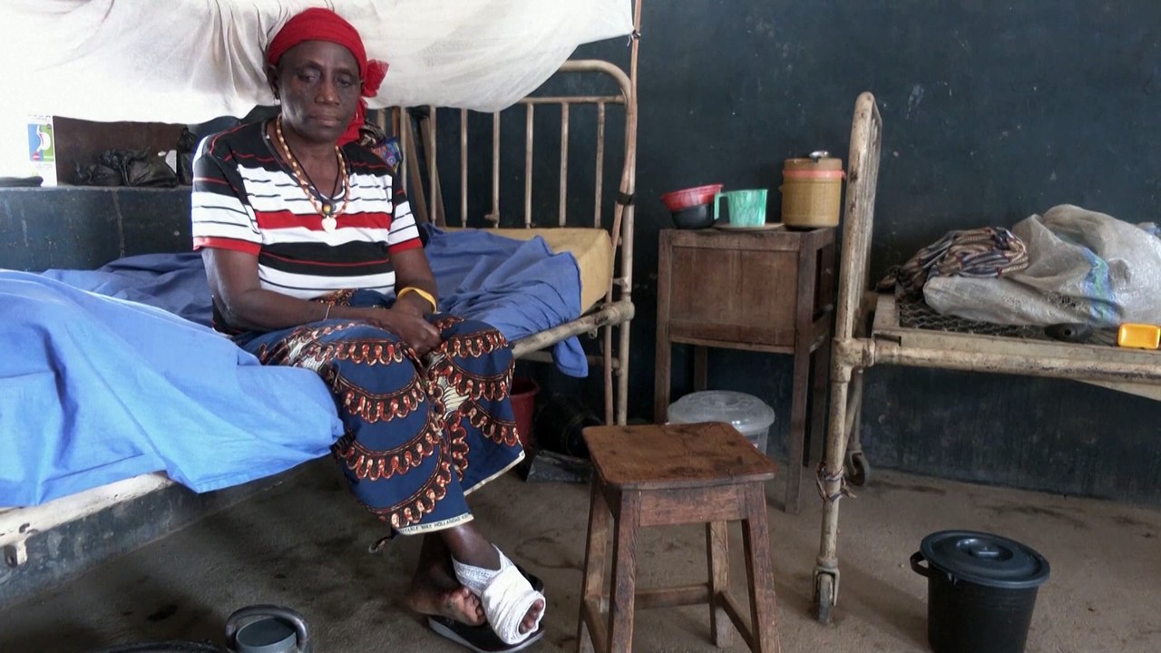 Nigeria to receive leprosy drugs after a year-long delay