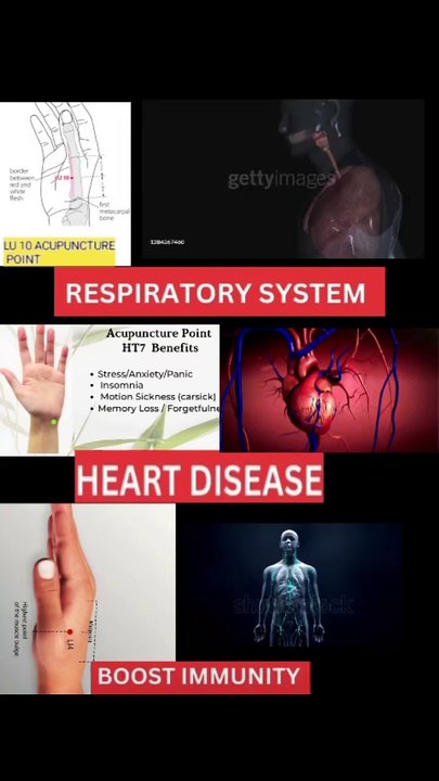 Acupuncture is effective at easing symptoms, reducing relapse rates, and improving lung and immune function in people with asthma.  Acupuncture also effective for treatment and prevention of cardiovascular diseases and can regulate immunity, for example,