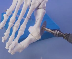 A step-by-step look at surgery procedures!