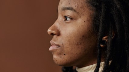 Why You Shouldn’t Pop Pimples On Your Nose, According to This One Person on Tiktok