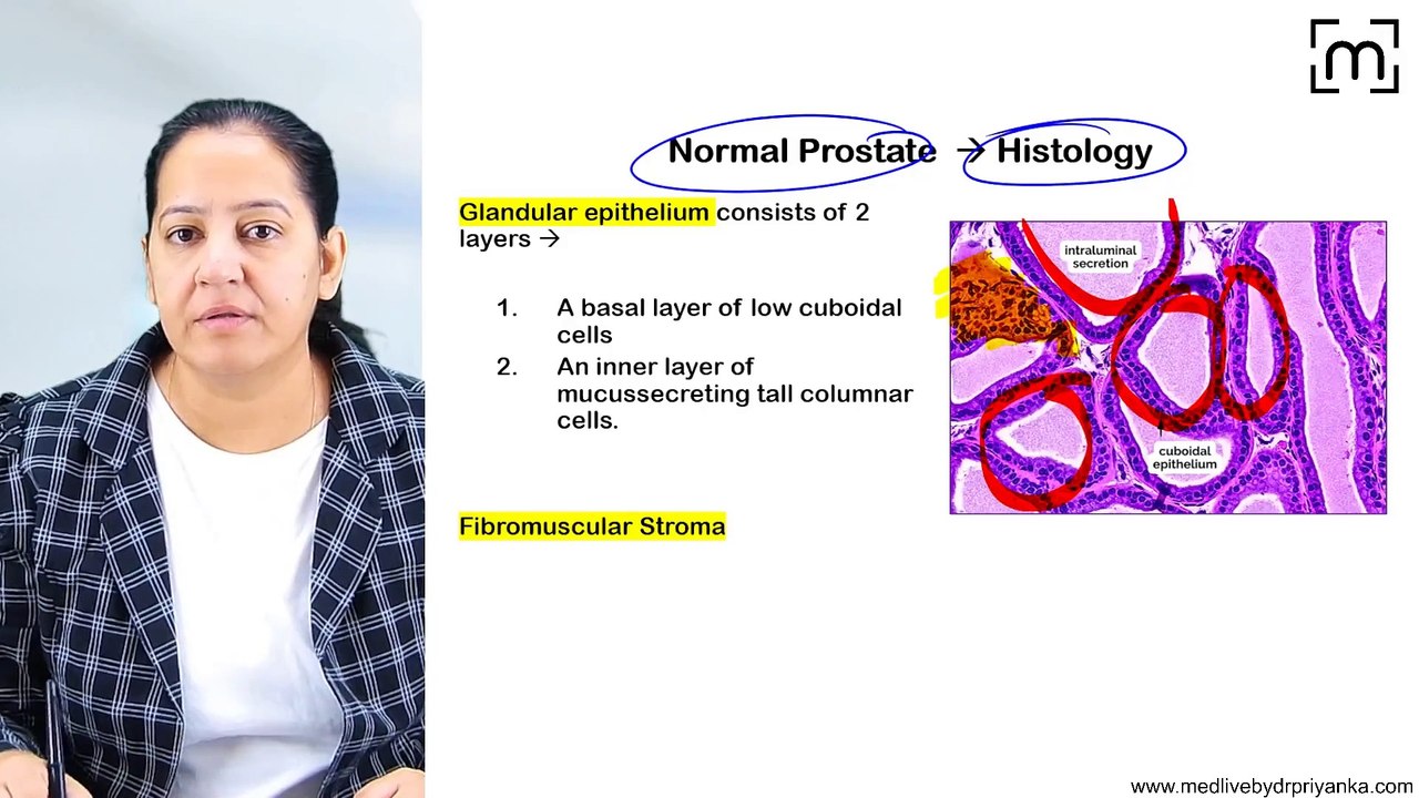 3. Benign Prostatic Hyperplasia & Prostate Carcinoma