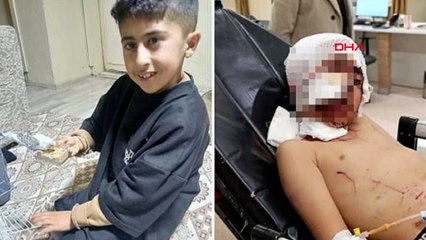 Bakkala giderken köpeklerin saldırısına uğrayan Murat, ağır yaralandı