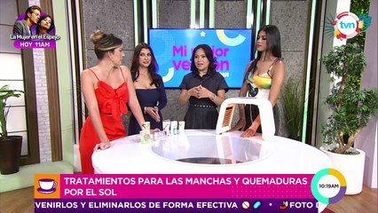 Mi mejor versión: Tratamientos para manchas y quemaduras por el sol