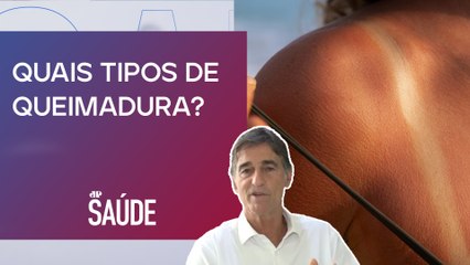 Como identificar intensidade das queimaduras de primeiro grau? | Dr. Juvenal Frizzo