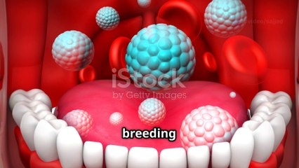 halitosis (bad breath)