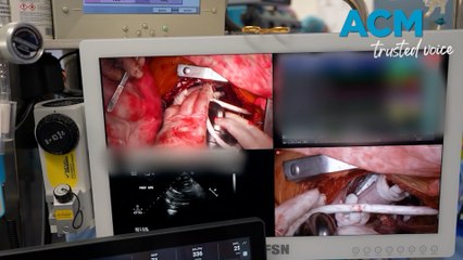 Australian becomes first in world discharged with durable artificial heart implant