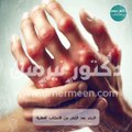 علاج التهاب المفاصل الروماتويدي #علاج #التهاب #التهابات_المفاصل #المفاصل #المفاصل_الروماتويدي #الروماتويد #التهابات