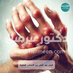 علاج التهاب المفاصل الروماتويدي #علاج #التهاب #التهابات_المفاصل #المفاصل #المفاصل_الروماتويدي #الروماتويد #التهابات