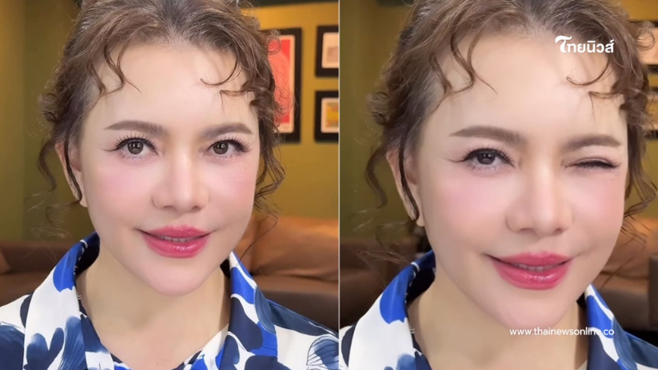 "หนูแหม่ม" อวดหน้าใหม่หลังศัลยกรรม 1 เดือน เด็กลงมาก จำแทบไม่ได้
