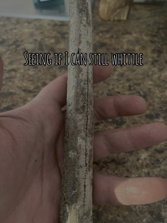 Lost my vision almost two years ago. My visual fields now range from 0-25% each eye at any given moment. Been a battle I have lost so much but I am not giving up the fight.