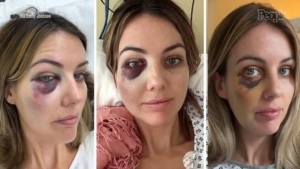 Woman Issues Warning After Life-Threatening Medical Emergency During 13-Hour Flight: ‘Miracle That I’m Still Alive’