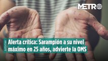 Alerta crítica: Sarampión a su nivel máximo en 25 años, advierte la OMS