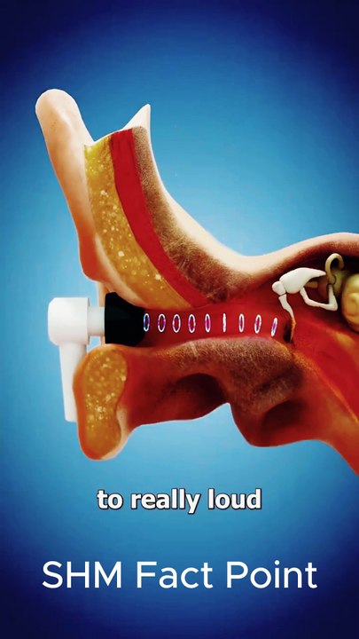 "Warning: High Volume Headphones Can Damage Your Ears! 🎧⚠️" #shorts #shortsfeed #short #trending