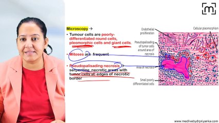 2. Tumors of CNS