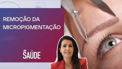 Como é feito transplante de sobrancelhas? | Dra. Ana Carina