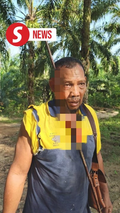 Man survives after iron rod pierces face