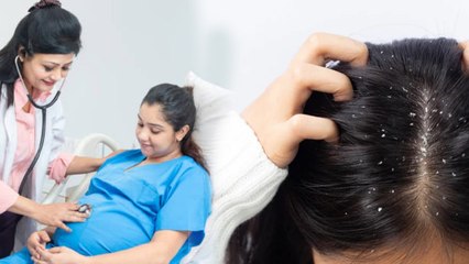 Dandruff After Delivery Reason :  डिलीवरी के बाद डैंड्रफ का कारण और घरेलु इलाज |  Boldsky