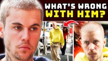 Justin Bieber Is Spiraling and Needs Help! But He Denies It