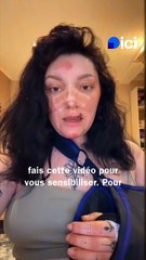 Maëlle, 20 ans, témoigne de son grave accident de la route en Dordogne