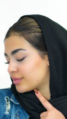 تزریق فیلر چانه: راهی برای فرم‌دهی و زیباسازی صورت