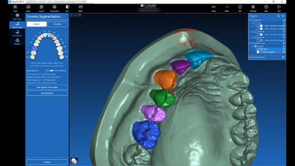 Создание собственной библиотеки зубов в RealGuide 5