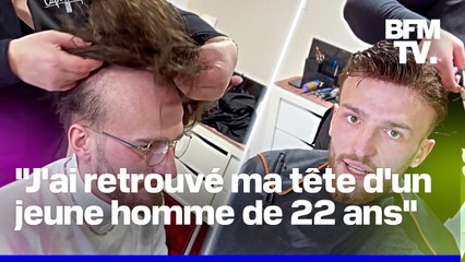 "Ça vaut le prix": contre la calvitie, Jules a décidé d'opter pour les compléments capillaires