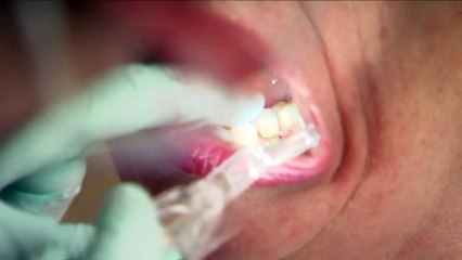 Calls for free dental care for seniors as hospitalisations surge